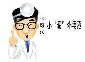 怎么判断自己是得了外痔疮,怎么判断自己得了外痔疮