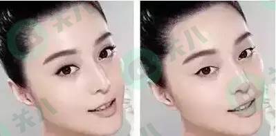 达康书记和白百何电影,达康张雨绮