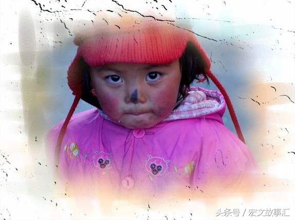 小孩擦鼻子鼻子下边黑了一小片,帮忙给小孩子擦鼻子