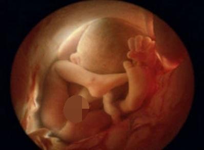 怀孕六个月下身有血迹以为流产,去医院后医生都哭笑不得