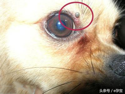 2岁女童反复高烧查不出原因,2岁娃高烧不退