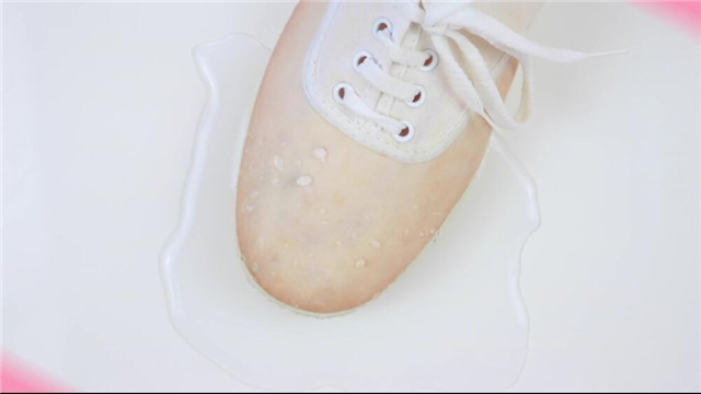 最全洗鞋大法,洗鞋怎么才能又快又干净