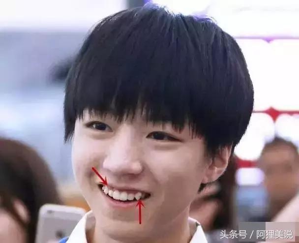 隐适美矫正摘戴攻略,隐适美和正雅隐形矫正哪个好