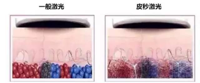 韩辰整形医院武汉光子嫩肤,南京韩辰整形皮肤科电话