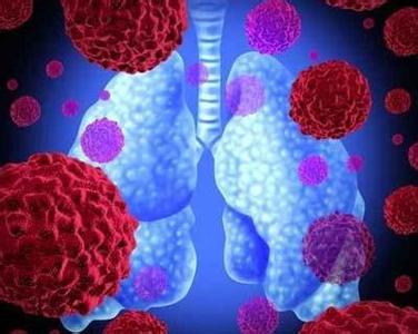 肺癌靶向治疗药物最常用的,最新治疗肺癌靶向药物