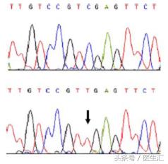 神经内科疾病诊断公式,神经系统疾病的诊断思路及步骤