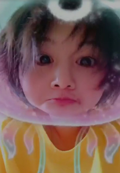 郑爽压力大深夜失眠嘴角上火，早晨起床头发凌乱不忘卖萌放飞自我