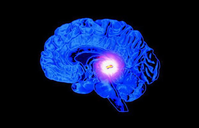 人类曾经确实有“第三只眼”，现在还隐藏在大脑中！