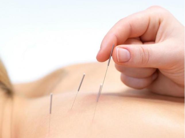 中医针灸科治疗流程,伤科疾病针灸疗法