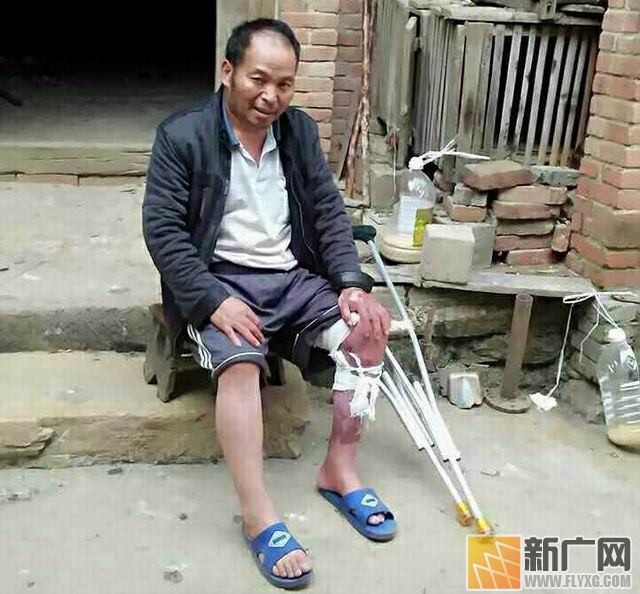 彝族村民李增贵烤贾酒盼脱贫遇火灾，栽多少包谷才能抚平49%烧伤