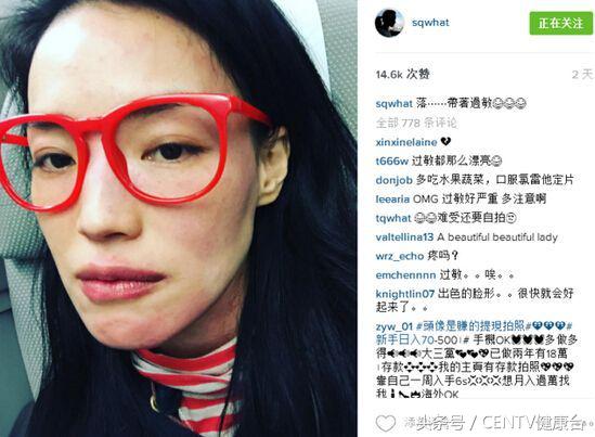 舒淇过敏化妆视频教程,舒淇皮肤敏感恢复