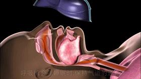 宁波的朋友打呼噜视频,失眠睡不着觉的朋友们看过来