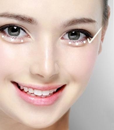 卧蚕和眼袋的区别你知道吗,卧蚕和眼袋的区别照片