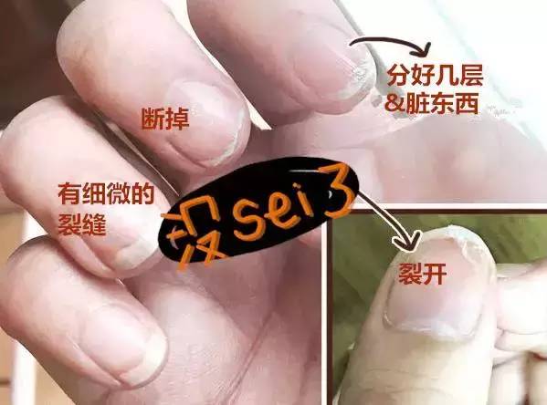 指甲又薄又锋利怎么办,指甲又薄又软该怎么办