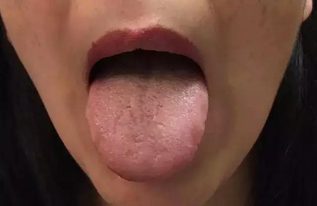 火不可乱降,上火应该做什么?