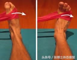 教你一招矫正o型腿,体态矫正康复训练
