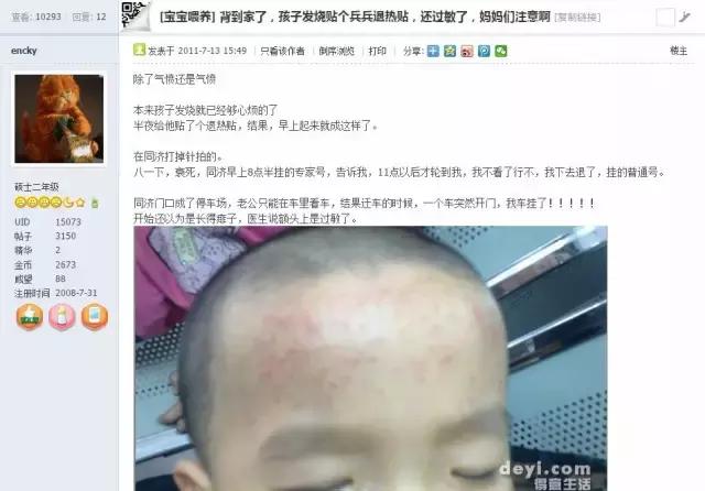 退烧贴过敏会全身起红疹吗,退热贴过敏皮肤有红斑