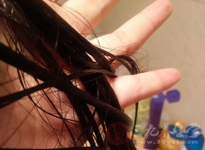 头皮屑多怎么把头皮屑洗干净,有头皮屑不洗头怎么去头皮屑