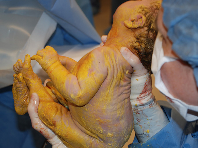 胎儿在肚子里为什么会吸入胎粪,胎儿在肚子里会不会拉屎尿尿