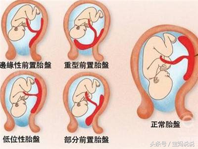 孕妈产检要带什么,孕妈检查表注意事项