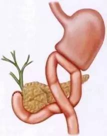 胃镜预处理流程,胃镜内镜手术全流程