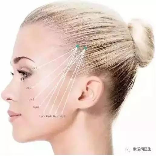 涨姿势正能量,范巨峰埋线提升多少钱