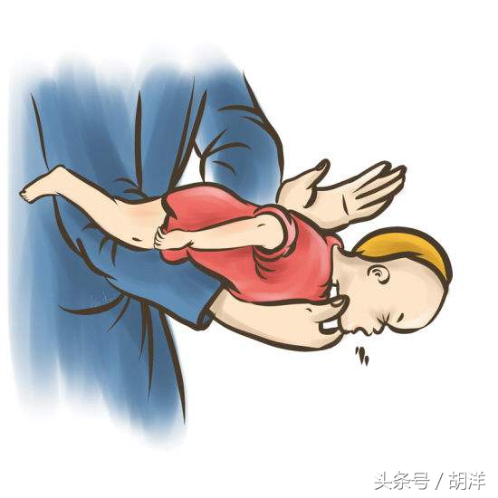 异物呛入气管的急救,呛到气管里异物急救法