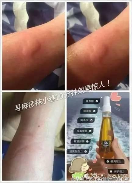 沙棘油，对皮肤还有如此神奇的效果