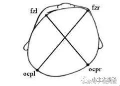 美国的宝宝扁头为什么要矫正,扁头在国外要做矫正吗