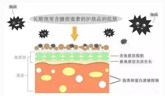 激素脸的症状和激素脸的治疗方法,到底什么是激素脸都有哪些症状