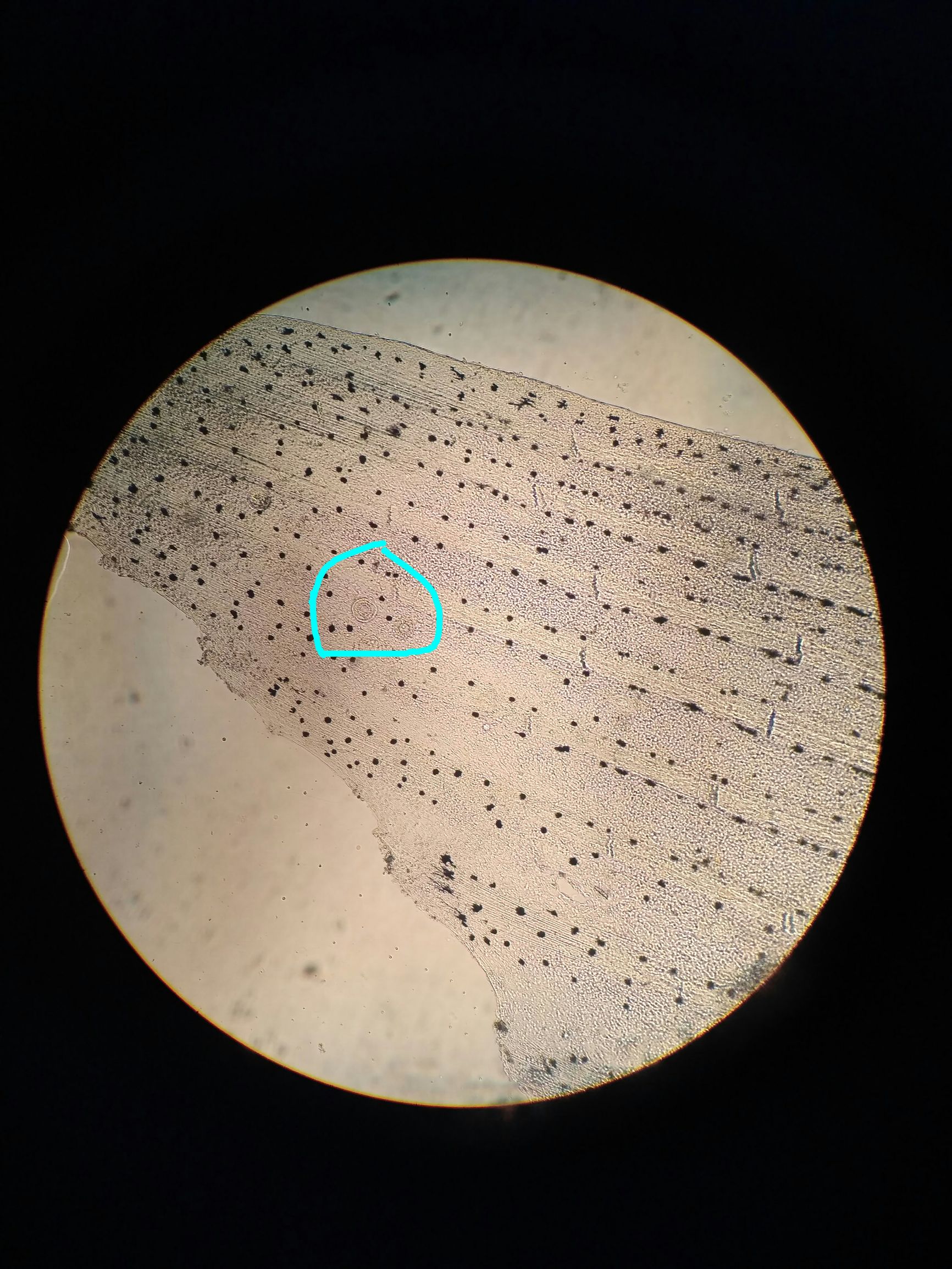 鲫鱼寄生虫防治,鱼苗感染车轮虫的症状