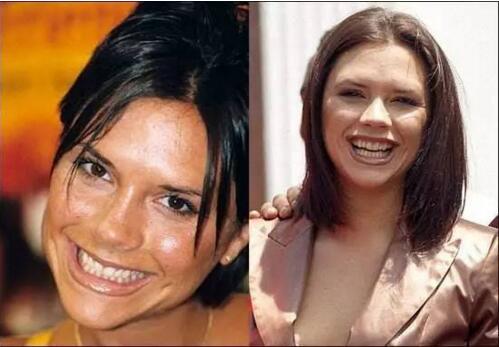 男生笑起来特别的丑怎么办,你长这么漂亮为什么却老说自己丑