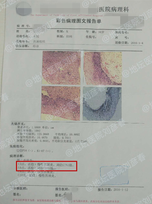 宫颈cin1级怎么做物理治疗,宫颈cin1级激光术后遗症