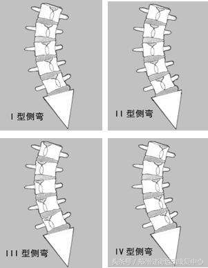 青少年腰痛膝盖痛,青少年腰痛一般是因为什么