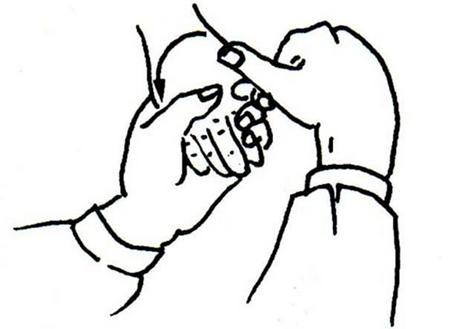 脑瘫孩子腕指关节屈曲、拇指内收训练