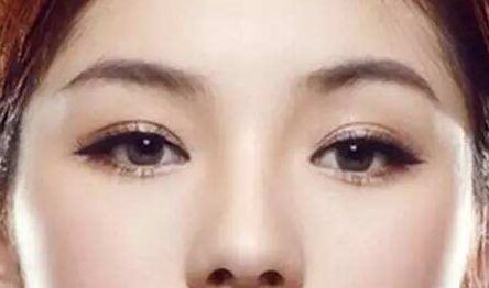 上眼睑轻微外翻有办法治疗吗,眼睑外翻治疗方案