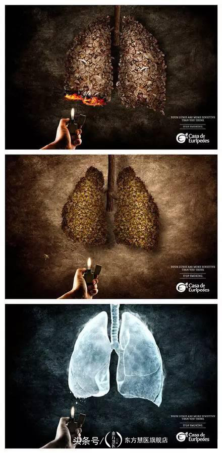 小孩患上咽炎怎么办,得咽炎该怎么办