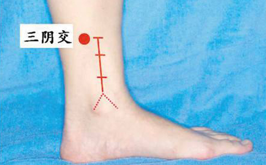 人流后出现什么症状会导致不孕,女生人流肚子刺痛是怎么回事