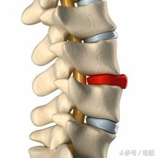 不小心把腰扭了怎么快速修复,不小心把腰扭了不太严重怎么处理