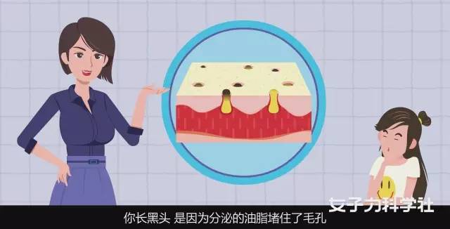 想去黑头收缩毛孔用什么成分,去黑头缩毛孔产品推荐微晶导入