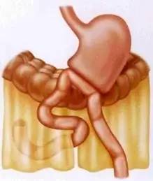 胃镜预处理流程,胃镜内镜手术全流程