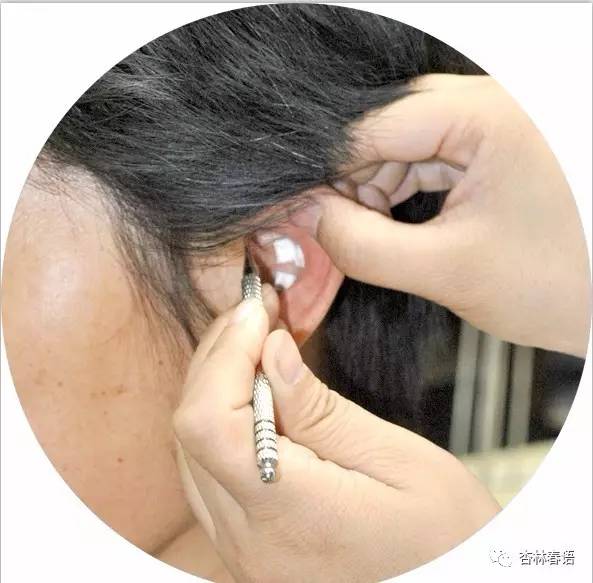 「中医养生保健素养常识」经穴养生之针刺\熏洗\耳压\刮痧