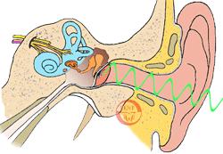 化脓性中耳炎基本知识