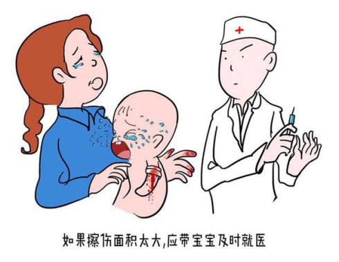 小儿急救常识高清,儿童急救常识100个小知识