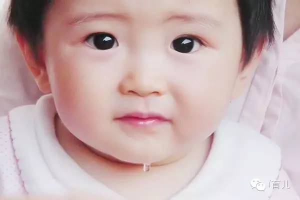 宝宝奶粉过敏怎么办最快解决,小孩子奶粉过敏是什么症状图片