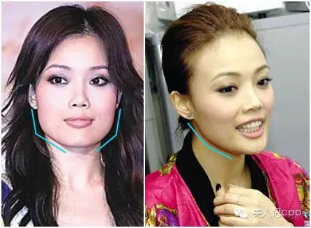 容祖儿淘汰了吗,容祖儿脸型是哪一种方脸