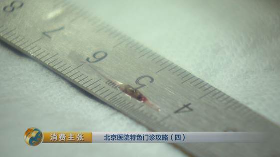 北京中医药专治肺结节的权威医院,治疗肺结节医院前十名