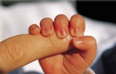 新生婴儿的脸变黄是怎么回事,刚出生小宝宝脸黄是怎么回事啊