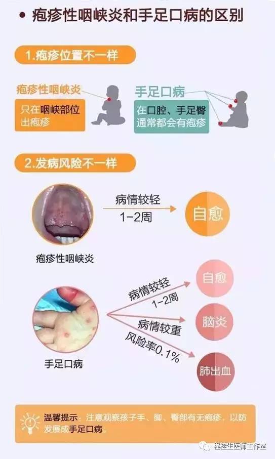 亮剑“疱疹性咽峡炎”,中医中药显良效！