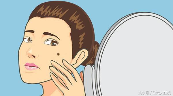 痣破损多久会有癌变的可能,浅表脂肪瘤样痣会癌变吗